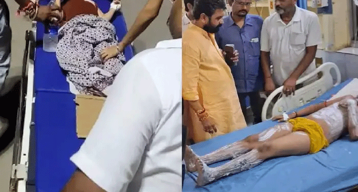 वाराणसी के आत्मविश्वेश्वर मंदिर में आग लगने से 7 लोग झुलसे