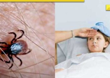 ہوشیار ! پُراسرار بخار اسکرب ٹائفس جان لیو ا ہو سکتا ہے