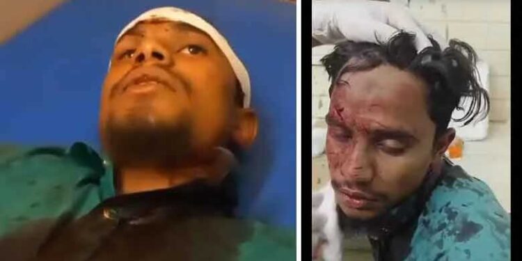 مسلم نوجوان پر حملہ کرنے والے ہنومان بھکت گرفتار