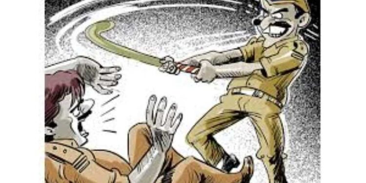 بہار میں گورنمنٹ ریل پولیس کا ظلم، مسلم مسافر کی آنتیں باہر نکل آئیں