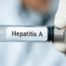 کیرالہ میں ہیپاٹائٹس اے نے وبا کی شکل اختیار کی