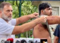 پیپر لیک احتجاج کے دوران زخمی طالب علم کو میڈیا کے سامنے لائے راہل